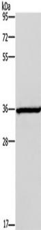 Iodothyronine Deiodinase 2 antibody, TA351141, Origene, Western Blot image 