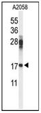 Ribosomal Protein S11 antibody, AP53732PU-N, Origene, Western Blot image 