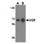 VGF Nerve Growth Factor Inducible antibody, NBP1-76906, Novus Biologicals, Western Blot image 