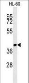 Sia-alpha-2,3-Gal-beta-1,4-GlcNAc-R:alpha 2,8-sialyltransferase antibody, LS-C161083, Lifespan Biosciences, Western Blot image 