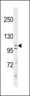 Alpha-mannosidase 2C1 antibody, LS-C157876, Lifespan Biosciences, Western Blot image 