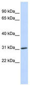 N(Alpha)-Acetyltransferase 10, NatA Catalytic Subunit antibody, TA346715, Origene, Western Blot image 