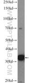 Glycine N-Methyltransferase antibody, 18790-1-AP, Proteintech Group, Western Blot image 
