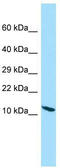 Protein phosphatase 1 regulatory subunit 14D antibody, TA334355, Origene, Western Blot image 