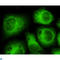Cyclin Dependent Kinase 5 antibody, LS-C812913, Lifespan Biosciences, Immunofluorescence image 