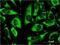 Ribosomal Protein Lateral Stalk Subunit P0 antibody, H00006175-M01, Novus Biologicals, Immunocytochemistry image 