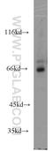 AarF Domain Containing Kinase 5 antibody, 17579-1-AP, Proteintech Group, Western Blot image 