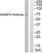 ADAM Metallopeptidase Domain 10 antibody, TA313421, Origene, Western Blot image 