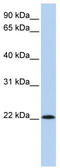 Ribonuclease A Family Member 11 (Inactive) antibody, TA340397, Origene, Western Blot image 