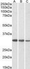 F-actin-capping protein subunit beta antibody, GTX89785, GeneTex, Western Blot image 