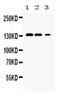 Janus Kinase 1 antibody, PA5-79546, Invitrogen Antibodies, Western Blot image 