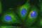 CALCOCO2 antibody, ab68588, Abcam, Immunocytochemistry image 