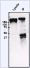 EGFR antibody, PA1-1110, Invitrogen Antibodies, Immunoprecipitation image 