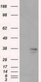 Pim-2 Proto-Oncogene, Serine/Threonine Kinase antibody, TA501060, Origene, Western Blot image 
