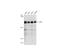 ATRX Chromatin Remodeler antibody, NBP1-32851, Novus Biologicals, Western Blot image 