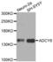 Adenylate Cyclase 8 antibody, abx002593, Abbexa, Western Blot image 