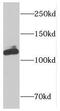 DIS3 Like Exosome 3'-5' Exoribonuclease antibody, FNab02395, FineTest, Western Blot image 