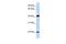 Protein lin-7 homolog C antibody, GTX46949, GeneTex, Western Blot image 