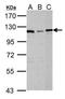 Dihydropyrimidine Dehydrogenase antibody, PA5-22302, Invitrogen Antibodies, Western Blot image 