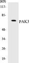 P21 (RAC1) Activated Kinase 3 antibody, EKC1438, Boster Biological Technology, Western Blot image 