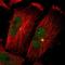 Podoplanin antibody, NBP1-90211, Novus Biologicals, Immunofluorescence image 