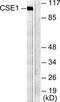 Chromosome Segregation 1 Like antibody, TA313180, Origene, Western Blot image 