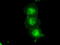 TYRO3 Protein Tyrosine Kinase antibody, LS-C784244, Lifespan Biosciences, Immunofluorescence image 