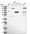 Erythrocyte Membrane Protein Band 4.1 antibody, HPA028412, Atlas Antibodies, Western Blot image 
