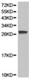 Amyloid P Component, Serum antibody, TA321386, Origene, Western Blot image 
