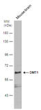 Solute Carrier Family 11 Member 2 antibody, GTX130889, GeneTex, Western Blot image 