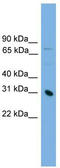 Serine Protease 8 antibody, TA342158, Origene, Western Blot image 