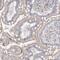 SH3 Domain Binding Protein 4 antibody, HPA037534, Atlas Antibodies, Immunohistochemistry paraffin image 