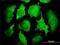PCNA Clamp Associated Factor antibody, H00009768-M01, Novus Biologicals, Immunofluorescence image 