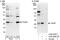 TP53 Induced Glycolysis Regulatory Phosphatase antibody, A302-285A, Bethyl Labs, Western Blot image 