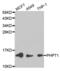 Phosphohistidine Phosphatase 1 antibody, PA5-75970, Invitrogen Antibodies, Western Blot image 