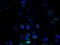 Chromosome 3 Open Reading Frame 20 antibody, A58366-100, Epigentek, Immunofluorescence image 
