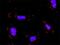 SUFU Negative Regulator Of Hedgehog Signaling antibody, H00051684-D01P, Novus Biologicals, Proximity Ligation Assay image 