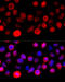 Bromodomain adjacent to zinc finger domain protein 1A antibody, 16-629, ProSci, Immunofluorescence image 