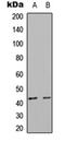 Dual Specificity Phosphatase 6 antibody, orb304740, Biorbyt, Western Blot image 