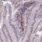 Scm Polycomb Group Protein Like 4 antibody, HPA065958, Atlas Antibodies, Immunohistochemistry paraffin image 