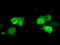 Cilia And Flagella Associated Protein 298 antibody, MA5-25159, Invitrogen Antibodies, Immunocytochemistry image 