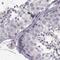 Zinc Finger Protein 185 With LIM Domain antibody, PA5-51381, Invitrogen Antibodies, Immunohistochemistry paraffin image 