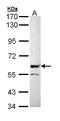 Serine/threonine-protein phosphatase 2B catalytic subunit beta isoform antibody, LS-B10793, Lifespan Biosciences, Western Blot image 
