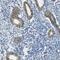 Membrane Spanning 4-Domains A10 antibody, NBP2-31998, Novus Biologicals, Immunohistochemistry frozen image 