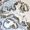 Lamin A/C antibody, LS-C354018, Lifespan Biosciences, Immunohistochemistry paraffin image 