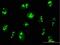 Ribosomal Oxygenase 1 antibody, H00079697-B01P, Novus Biologicals, Immunocytochemistry image 