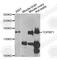 DNA Topoisomerase II Binding Protein 1 antibody, A5781, ABclonal Technology, Western Blot image 