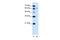 Solute carrier family 15 member 4 antibody, PA5-42513, Invitrogen Antibodies, Western Blot image 