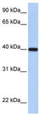 Retinol Dehydrogenase 11 antibody, TA346621, Origene, Western Blot image 