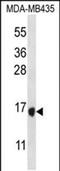 Tachykinin 4 antibody, PA5-48464, Invitrogen Antibodies, Western Blot image 